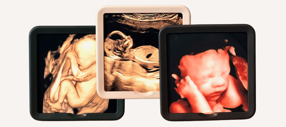 Unmute Hjertelyd og Indram Scanningsfoto Gave under graviditet