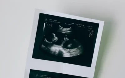 Guide til tidlig ultralydsscanning: Hvornår er det bedste tidspunkt?