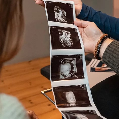 Gravid par ser de første ultralydsscanningsbilleder af foster
